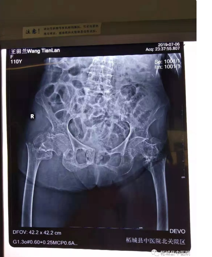 1563786395576338.png 2019-07-22_170517.png